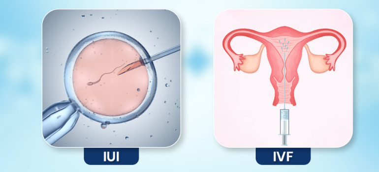 IUI vs IVF