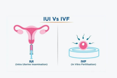 Difference Between IVF and IUI