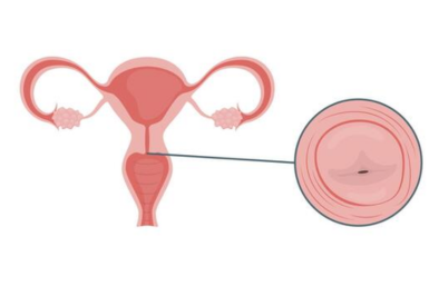 IVF vs Natural Pregnancy Pros and Cons Guide